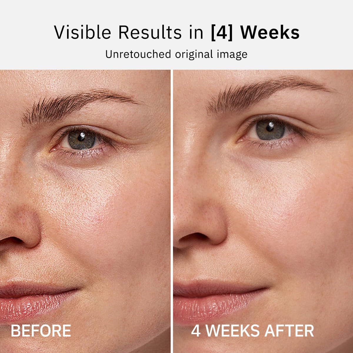 Rituel dermato: vitamine C matin et rétinol soir