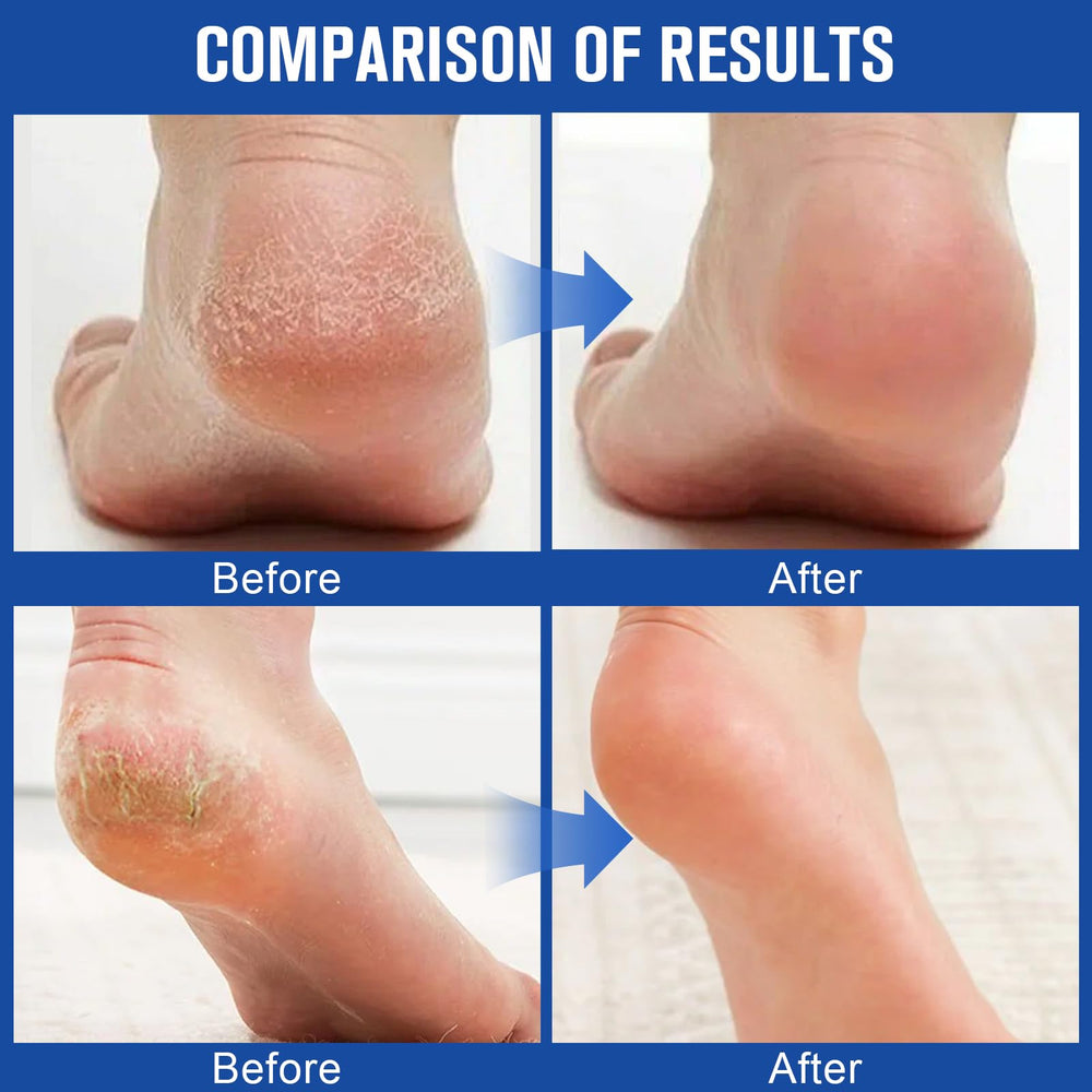 Holyarm Urea – texture légère et absorption rapide sans gras.