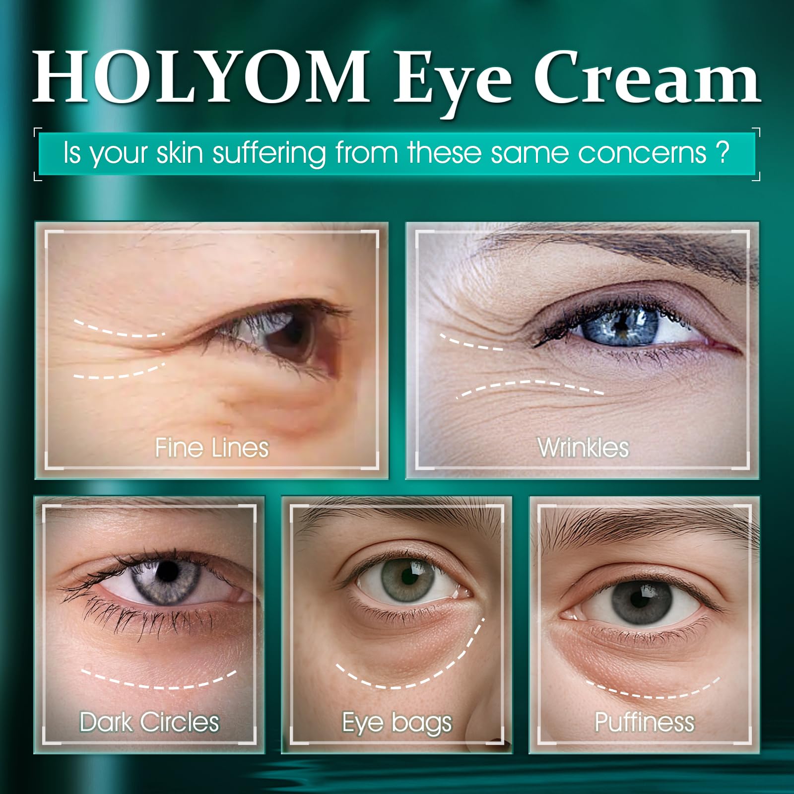 HOLYOM Crème Yeux Avancée – retinol léger pour revitaliser le regard.