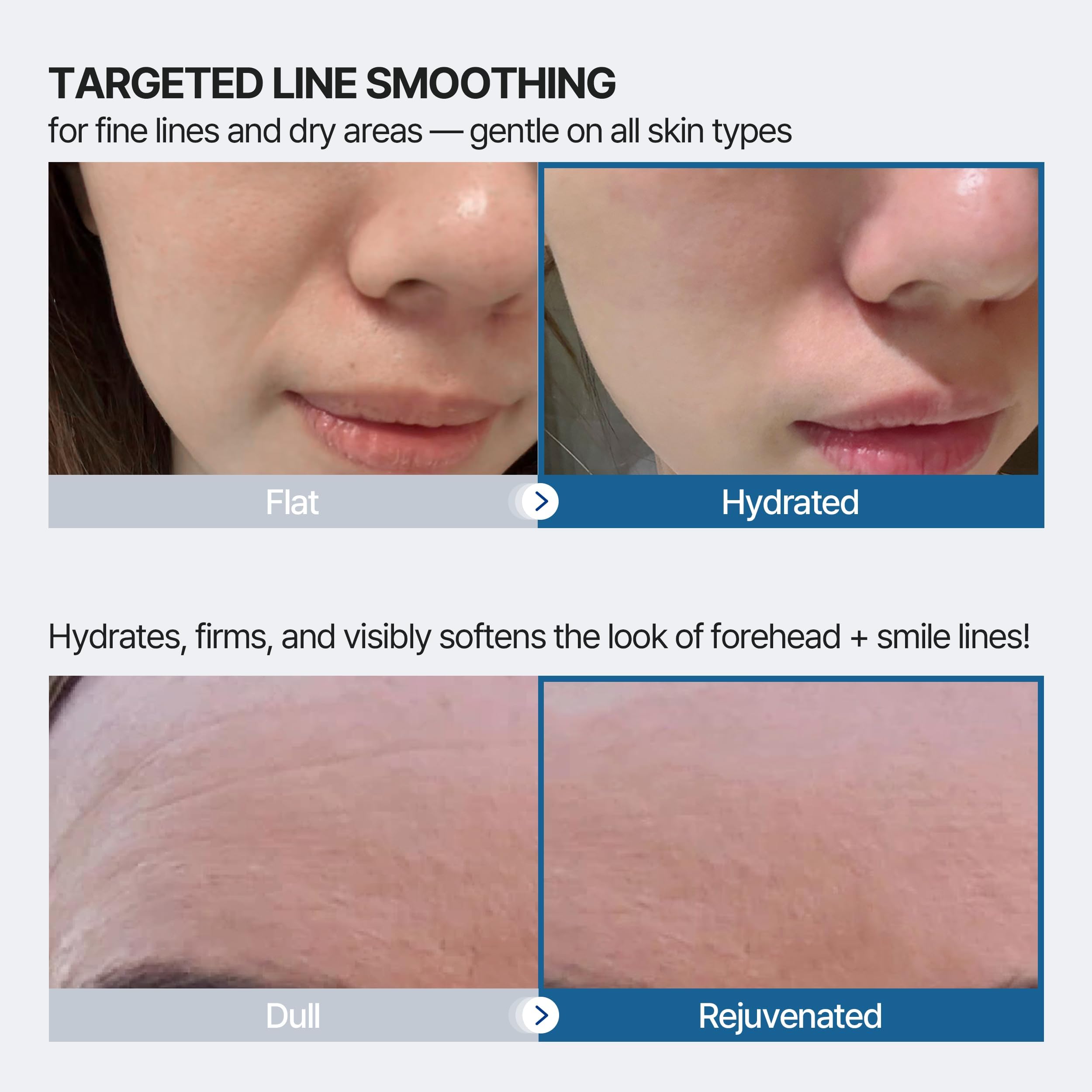 Patch Honeydew Labs nasolabial, couverture ciblée et hydratation