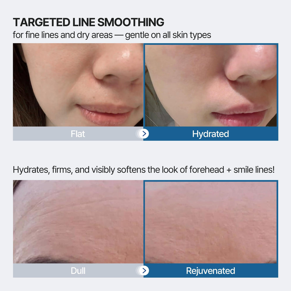 Patch Honeydew Labs nasolabial, couverture ciblée et hydratation