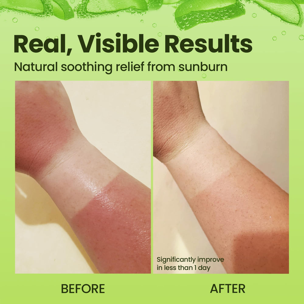 Honeyskin Gel Aloe Vera – Texture gel clair qui pénètre rapidement.