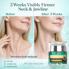 Hrorvei neck-jawline firming-application demonstrates smoothing and lift potential