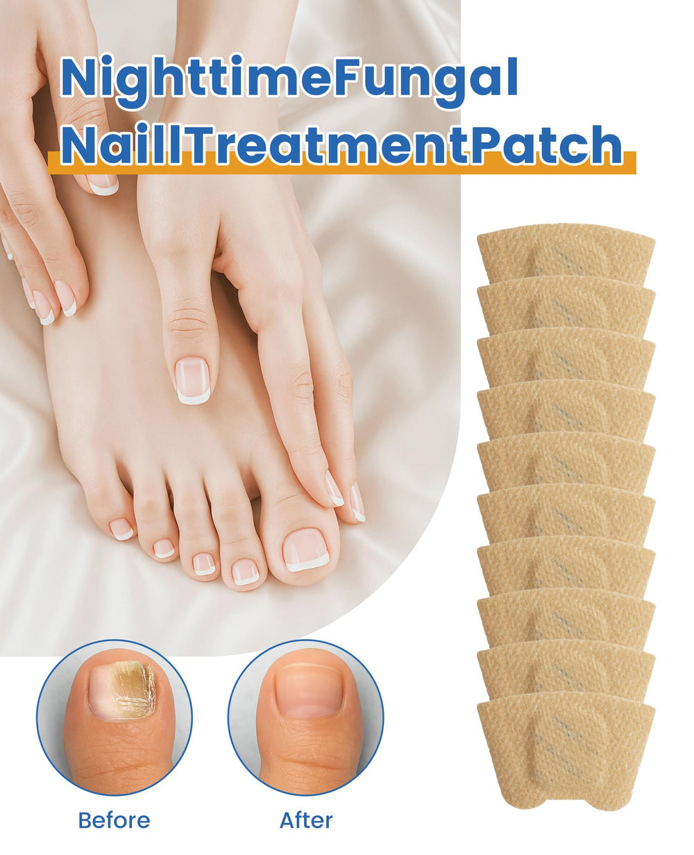 Patch HuiPoLii, traitement naturel des ongles, soutien à la croissance saine.
