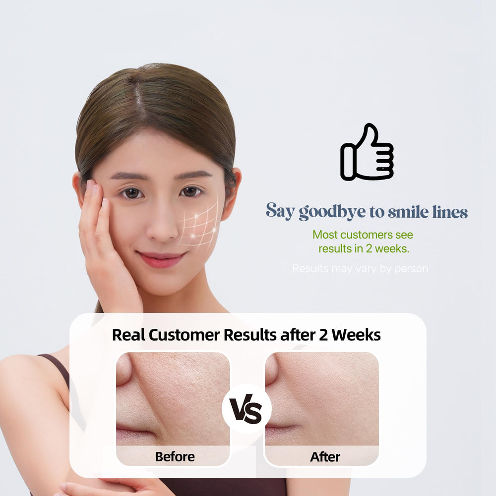 HYDROSMOOTH masque-rides-bouche : soin ciblé pour une bouche plus lissée.