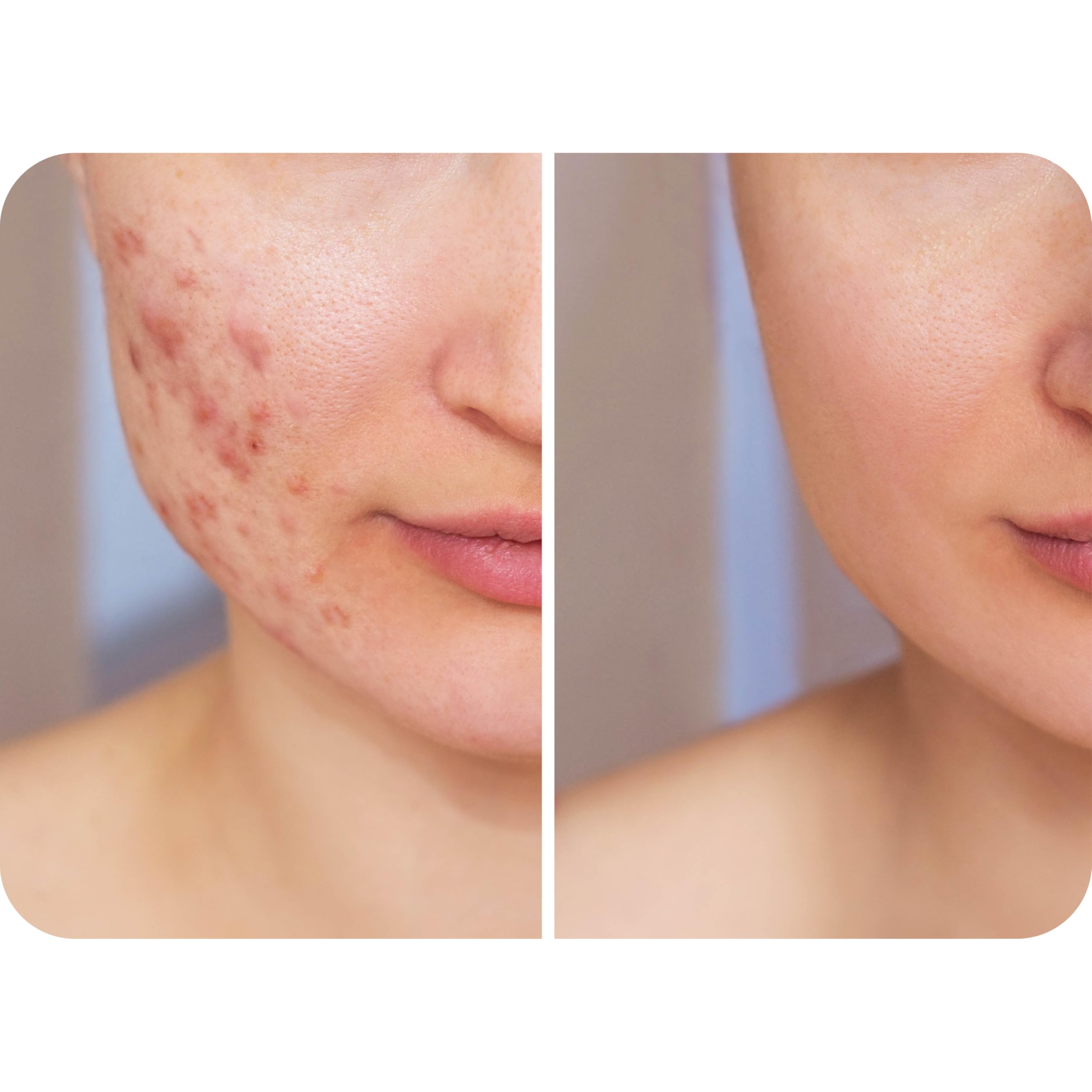 HypoClear voyage brume compacte, soin pratique en déplacement.