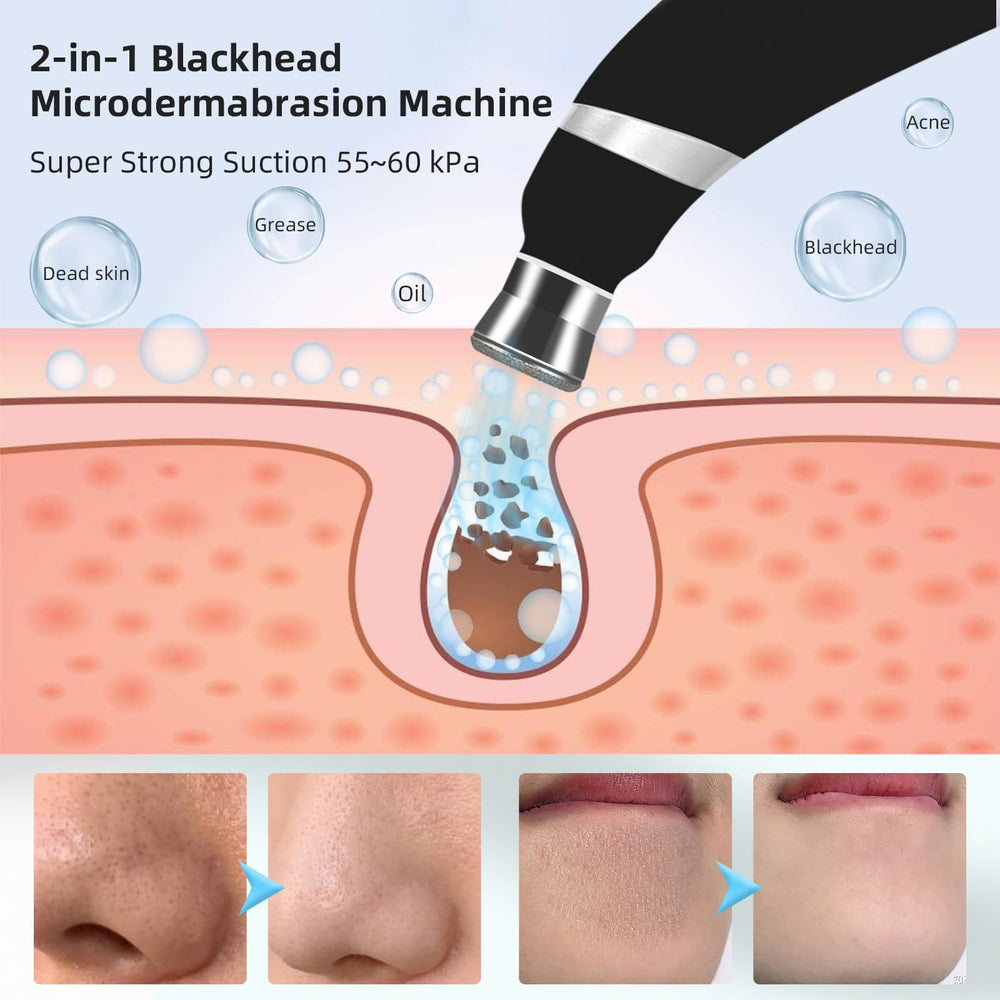 IeBilif 3 niveaux d’aspiration pour adapter le soin à votre peau