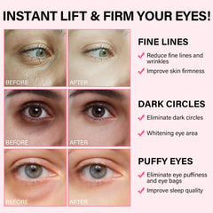 Patchs yeux iMethod Hyaluronate de Sodium offrent hydratation durable et douceur.
