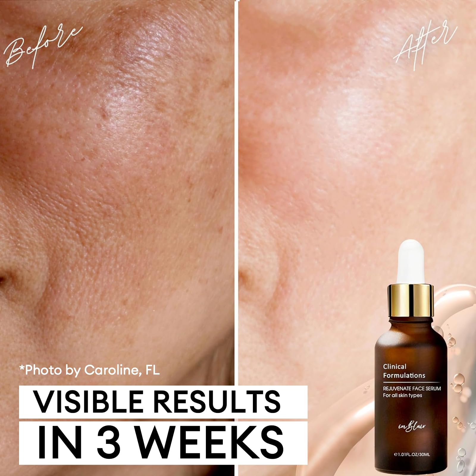 Inblair Sérum Visage, ingrédients clés hyaluronique et tremella pour peau hydratée.