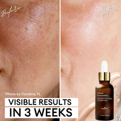 Inblair Sérum Visage, ingrédients clés hyaluronique et tremella pour peau hydratée.