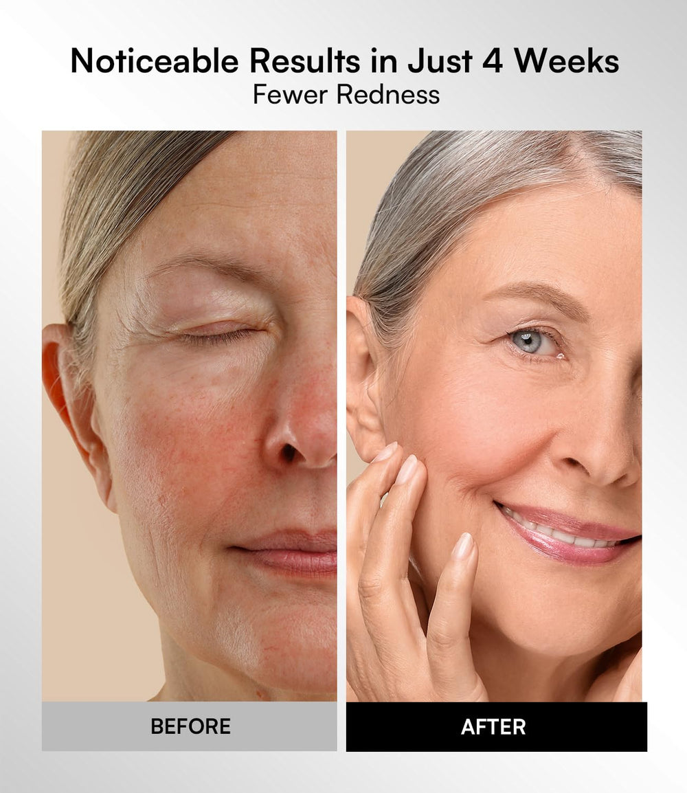 Masque INIA équipé d’une minuterie pour 10 minutes sur le visage.