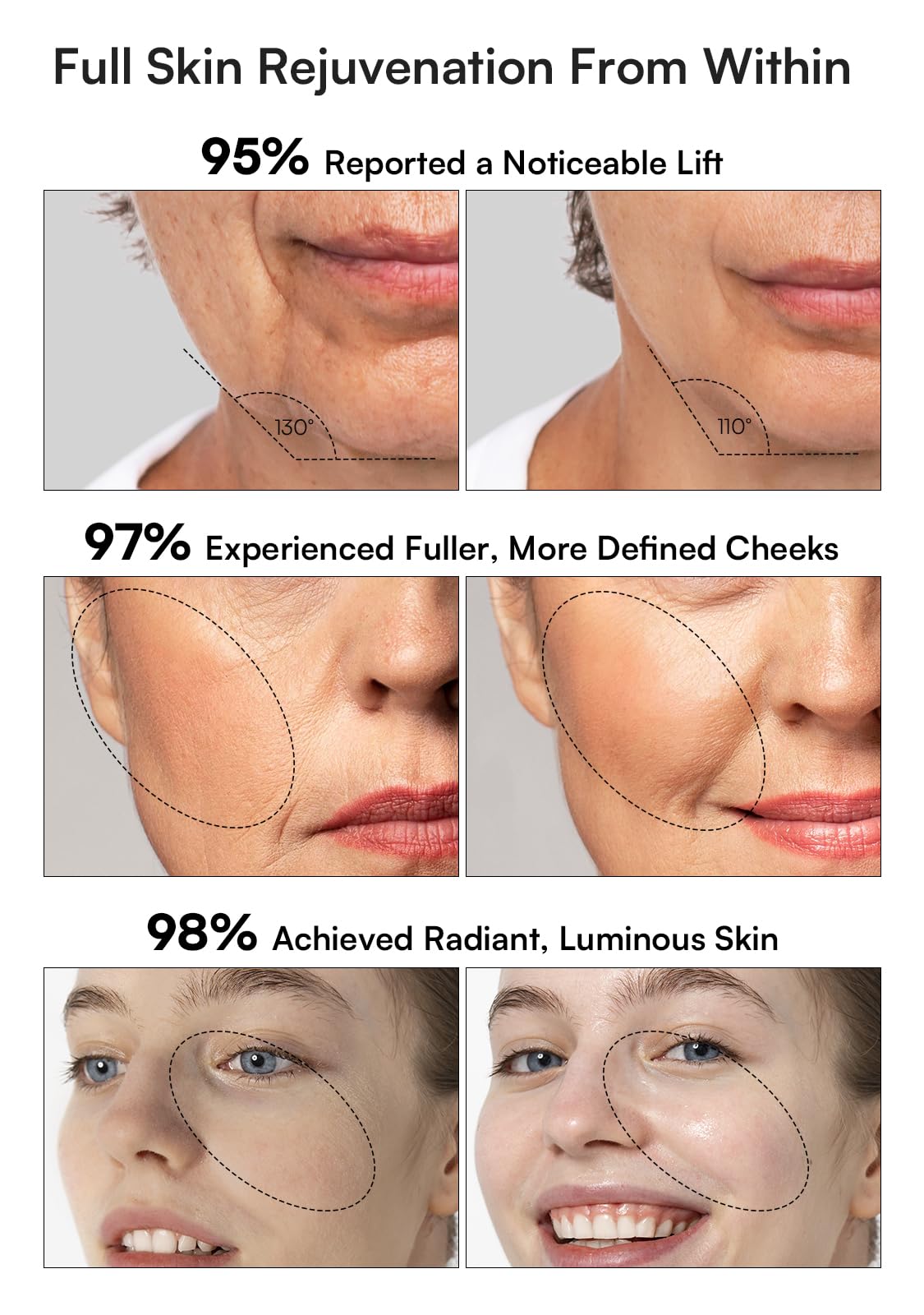 INIA mode levage raffermit les contours du visage.