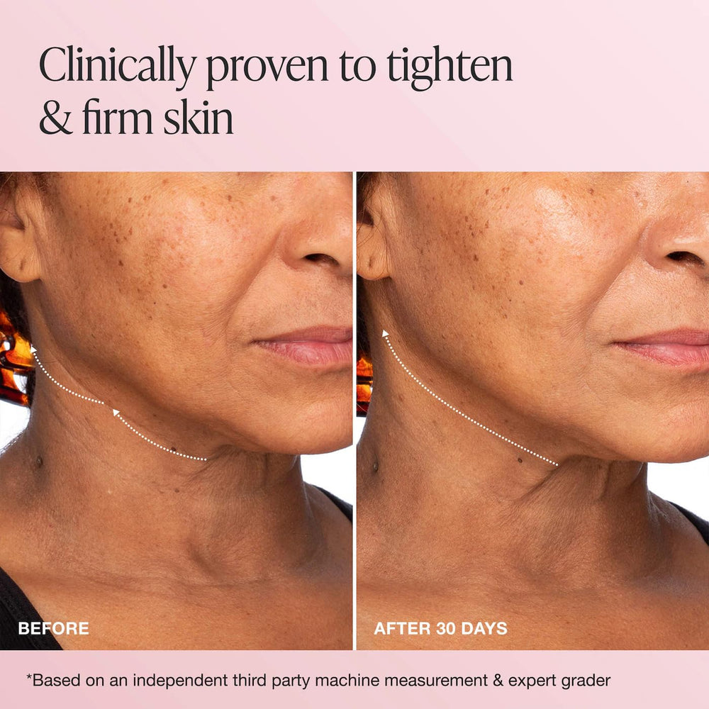 Innbeauty Project Crème Extrême – effet fermeté potentiel sur le contour.