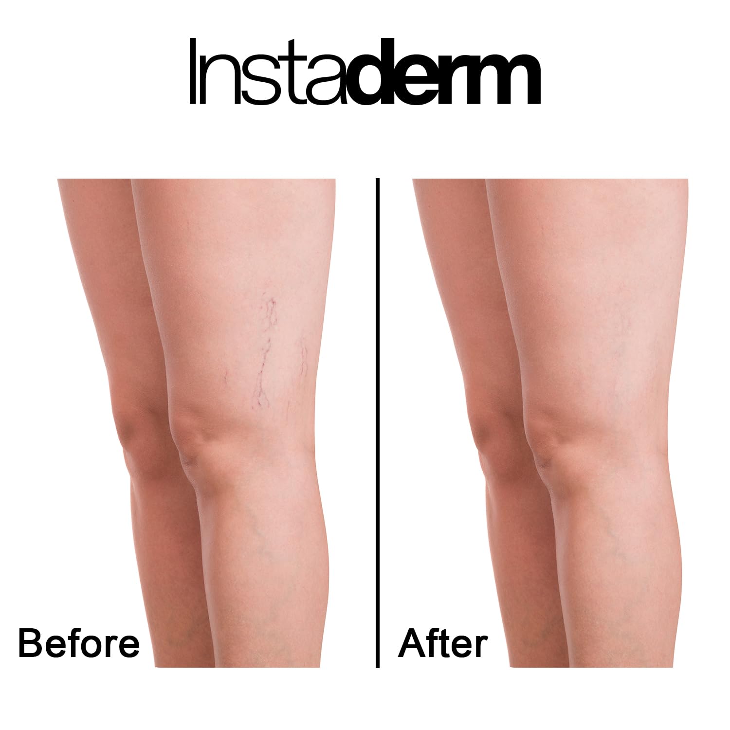 Instaderm Vitamine K Arnica hydratation durable pour peau saine