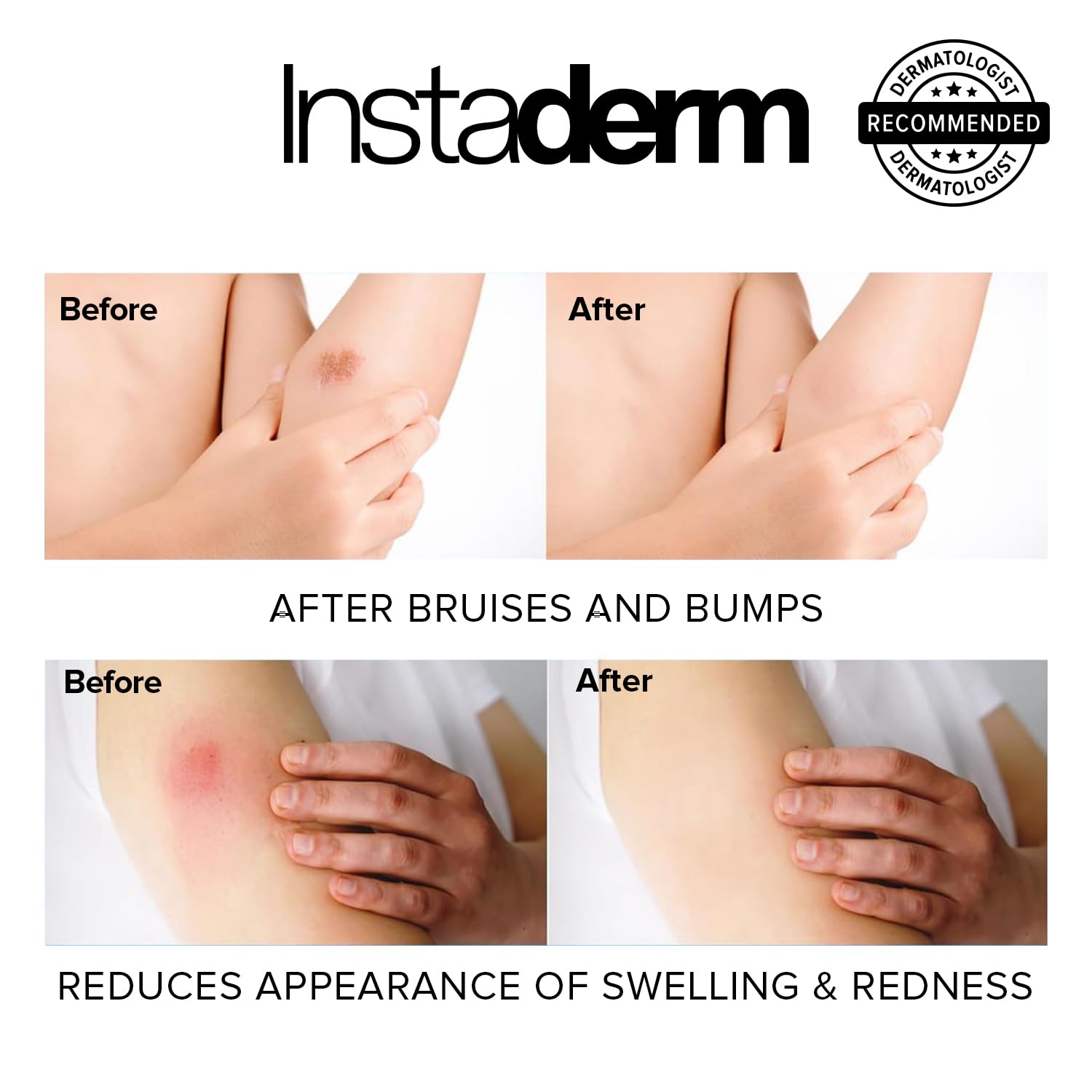 Instaderm Vitamine K Arnica relief des irritations et rougeurs mineures