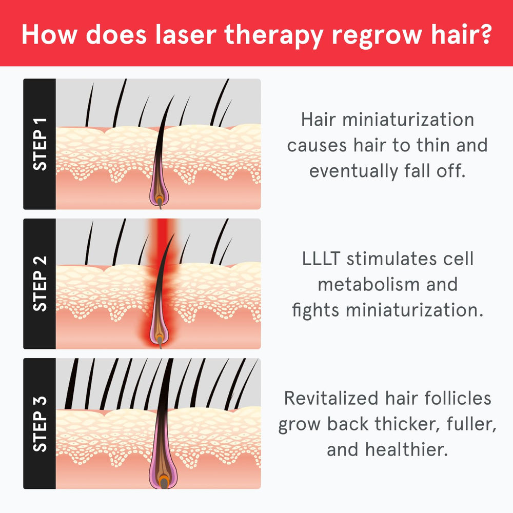 iRestore Essential cap laser portrait du cap ajustable et flexible.