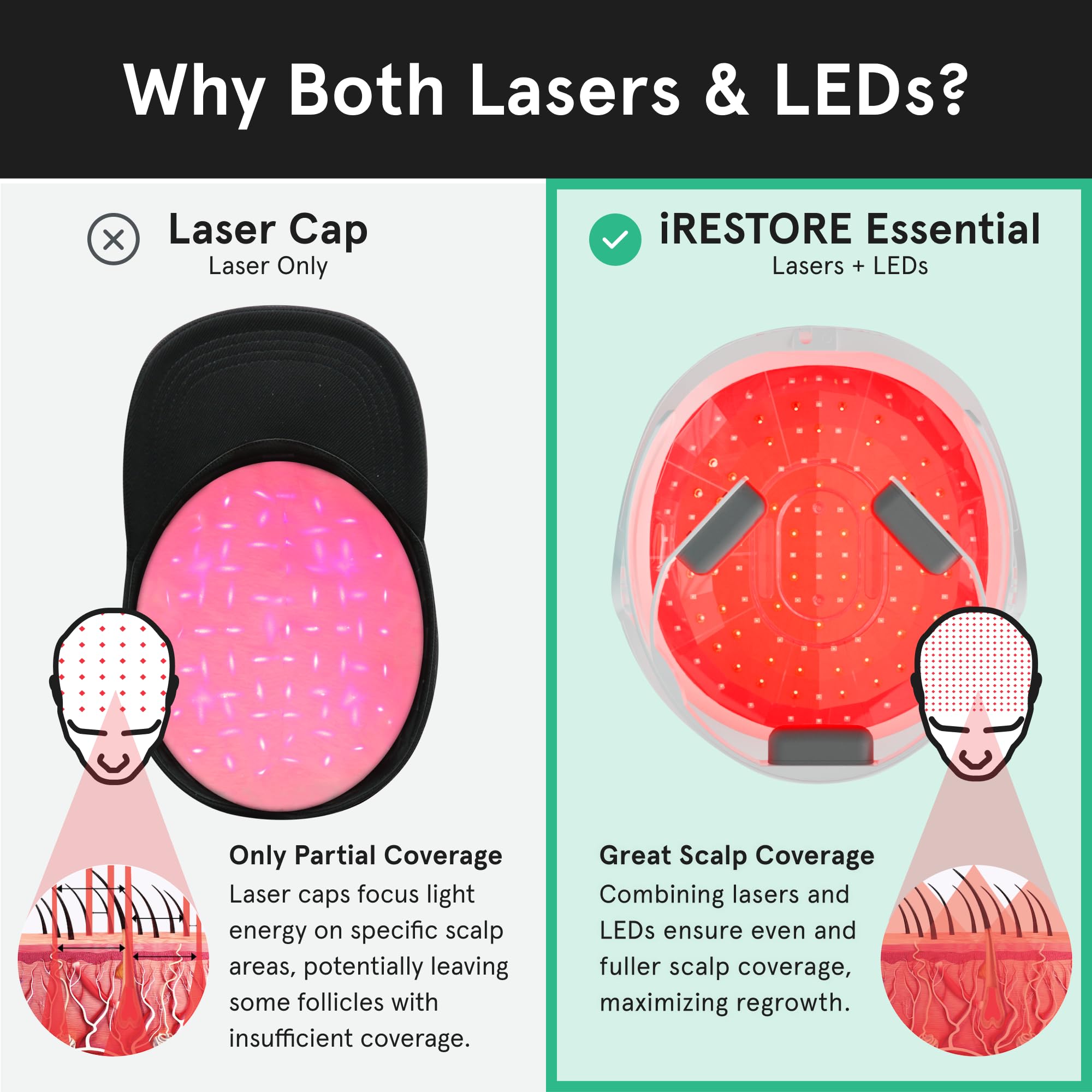 iRestore Essential cap laser montre une installation rapide et sans effort.