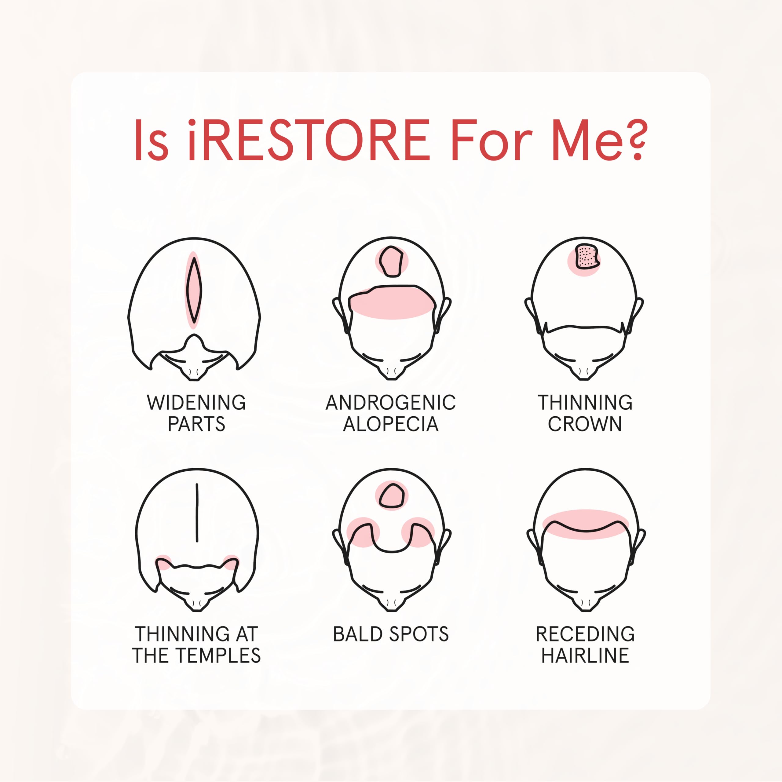 iRestore Shampoing cheveux-abimes: aide potentielle a redonner douceur et souplesse.