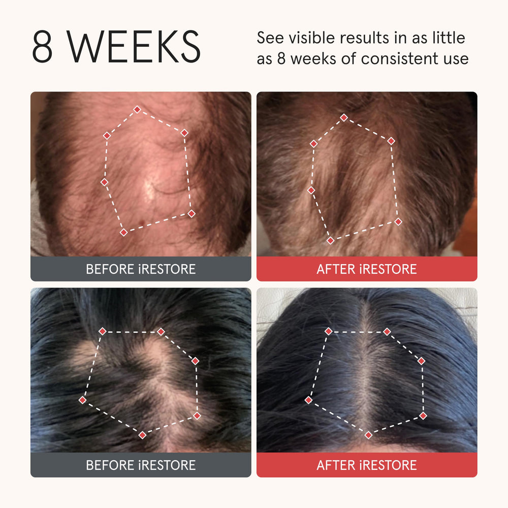 iRestore Shampoing epaisseur-cheveux: cheveux plus denses et volume durable.