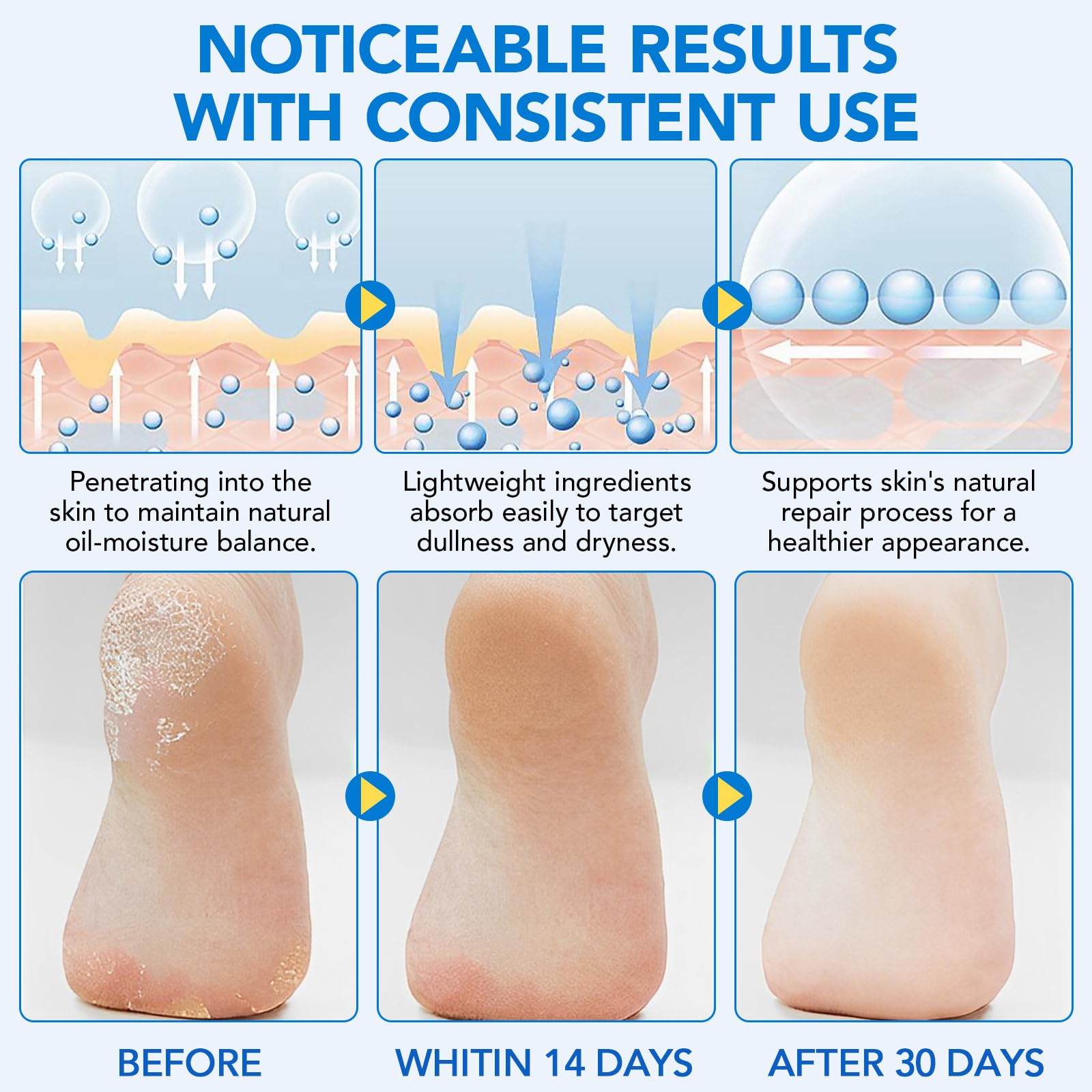 Aloe vera et Urée apportant hydratation durable sur les pieds.