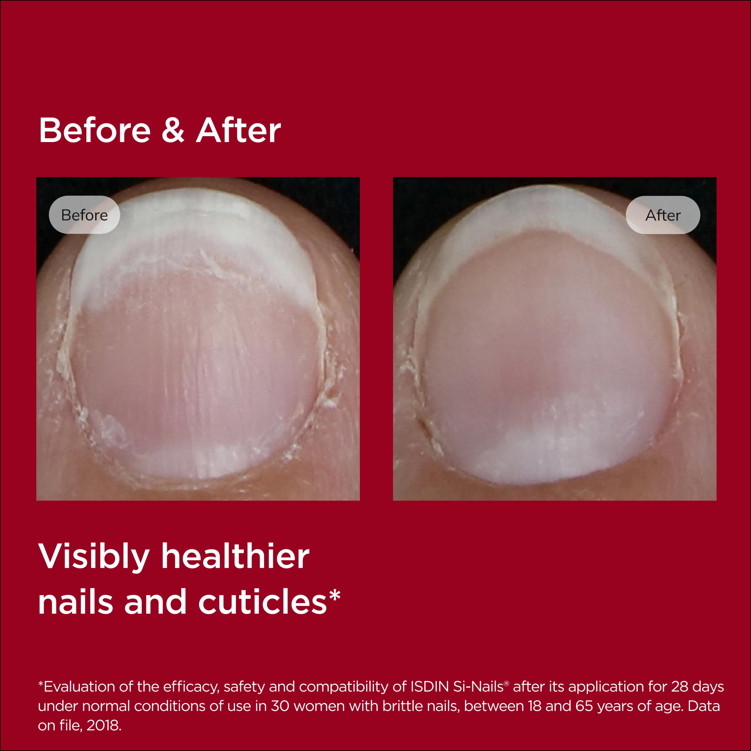 ISDIN Si-Nails: hydratation cuticulaire pour un confort accru.