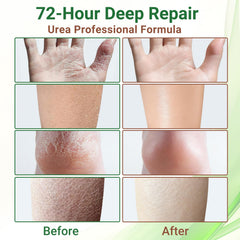 Application de la crème ishancare sur mains et talons pour usage quotidien.