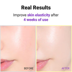 ISNTREE Hyper Retinol EX 1.0 Serum – absorption rapide, rituel nocturne.