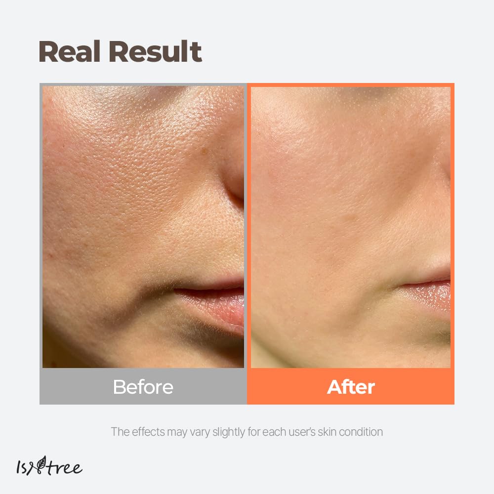 IsNtree Toner Frais au Thé Vert Flacon, diffusion douce et absorption rapide.