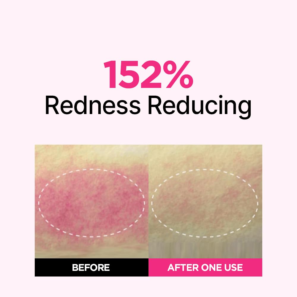 Huile de rose bulgare ISOI, nourrissante et apaisante pour la peau.