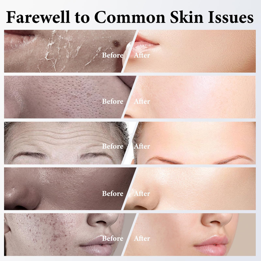 Masque collagène ISTON – convient à tous types de peau, même sensibles.