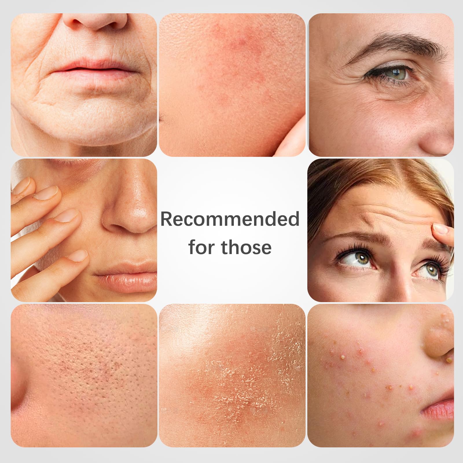ISTON Rosehip Masque – teint lumineux et éclat naturel