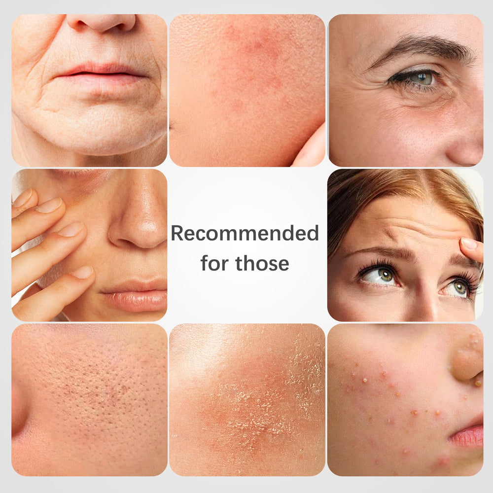 ISTON Rosehip Masque – teint lumineux et éclat naturel