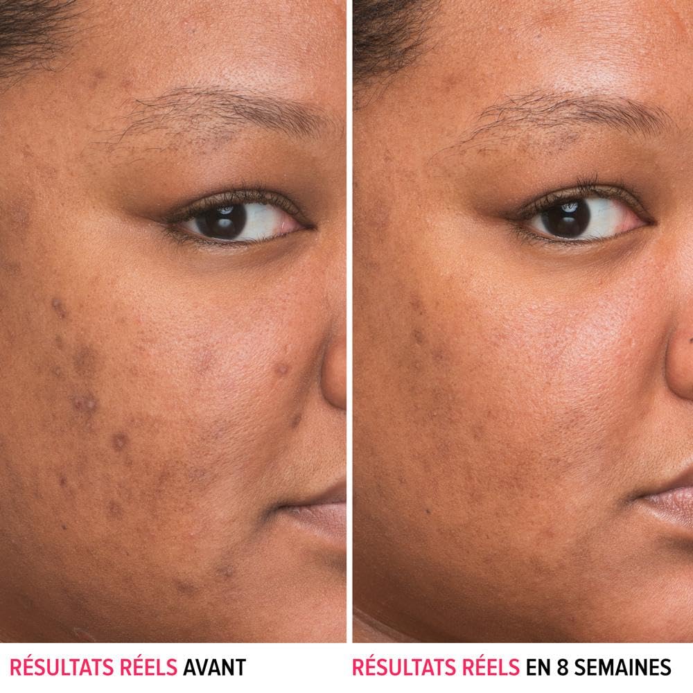 Gouttes du sérum IT Cosmetics appliquées sur le visage pour diffusion précise.