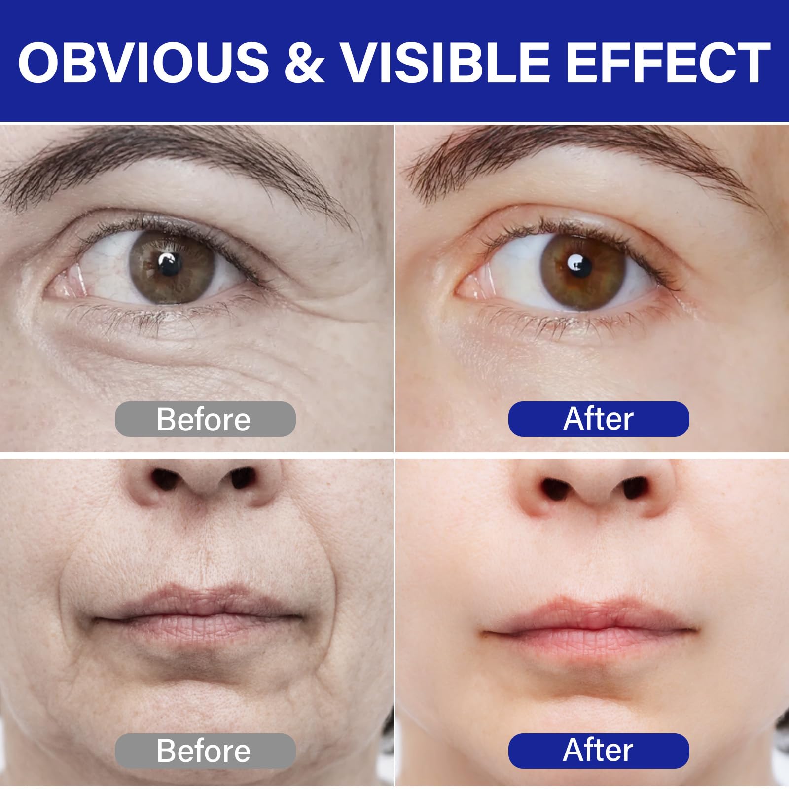 ITE CFREELY peptide complex vial emphasizes 50 peptide blend for plumpness