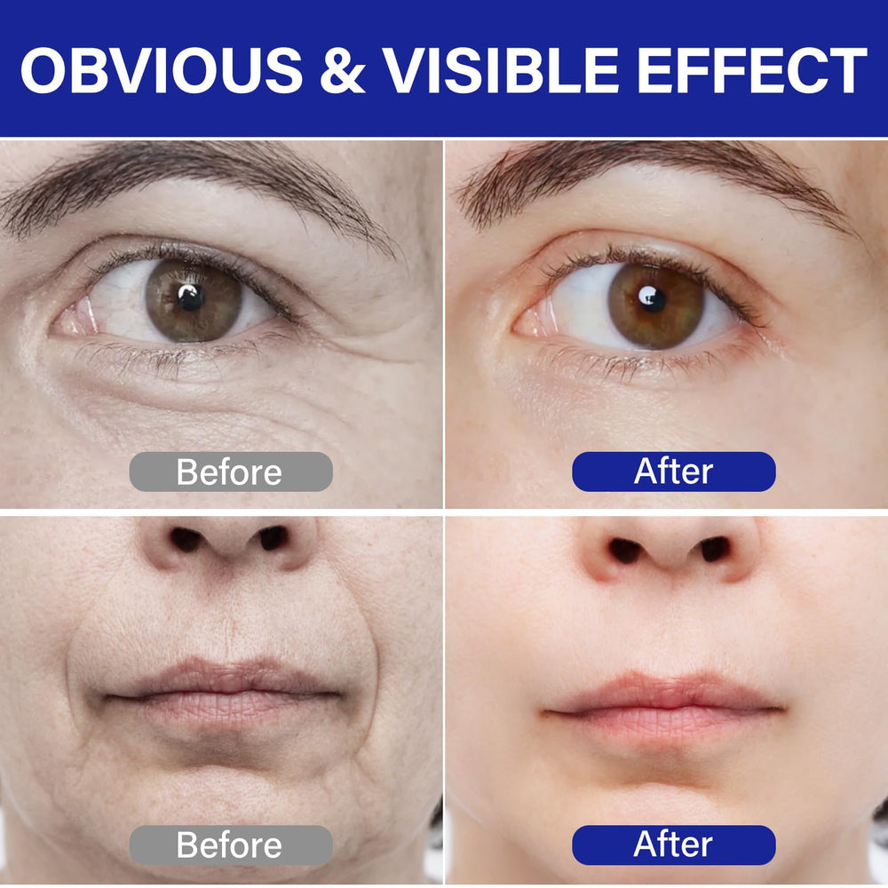 ITE CFREELY peptide complex vial emphasizes 50 peptide blend for plumpness