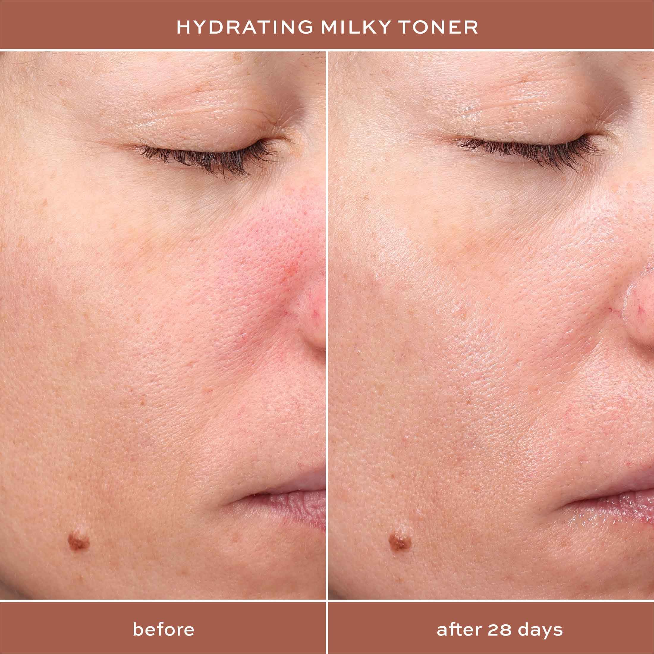Texture crèmeuse du toner prête à l’application ITK.