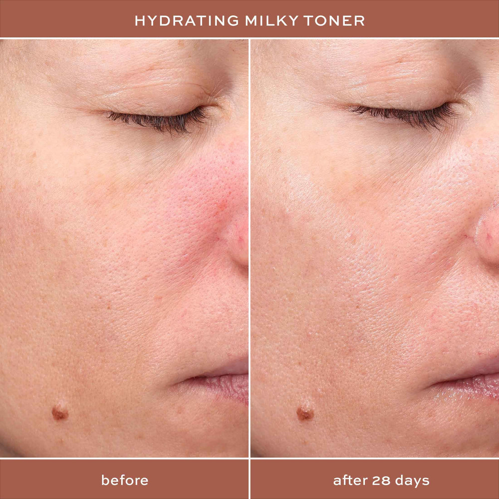 Texture crèmeuse du toner prête à l’application ITK.