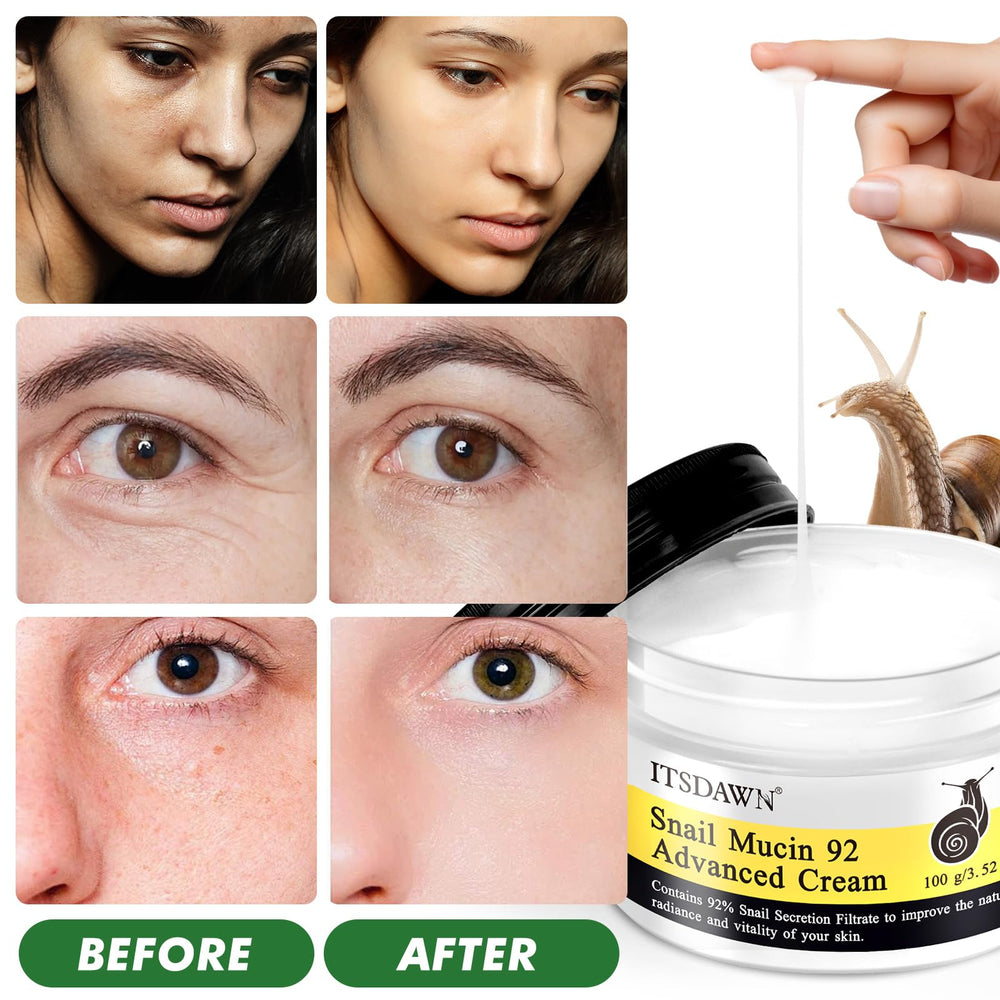 ITSDAWN Crème Mucin 92% formule naturelle et hypoallergénique.