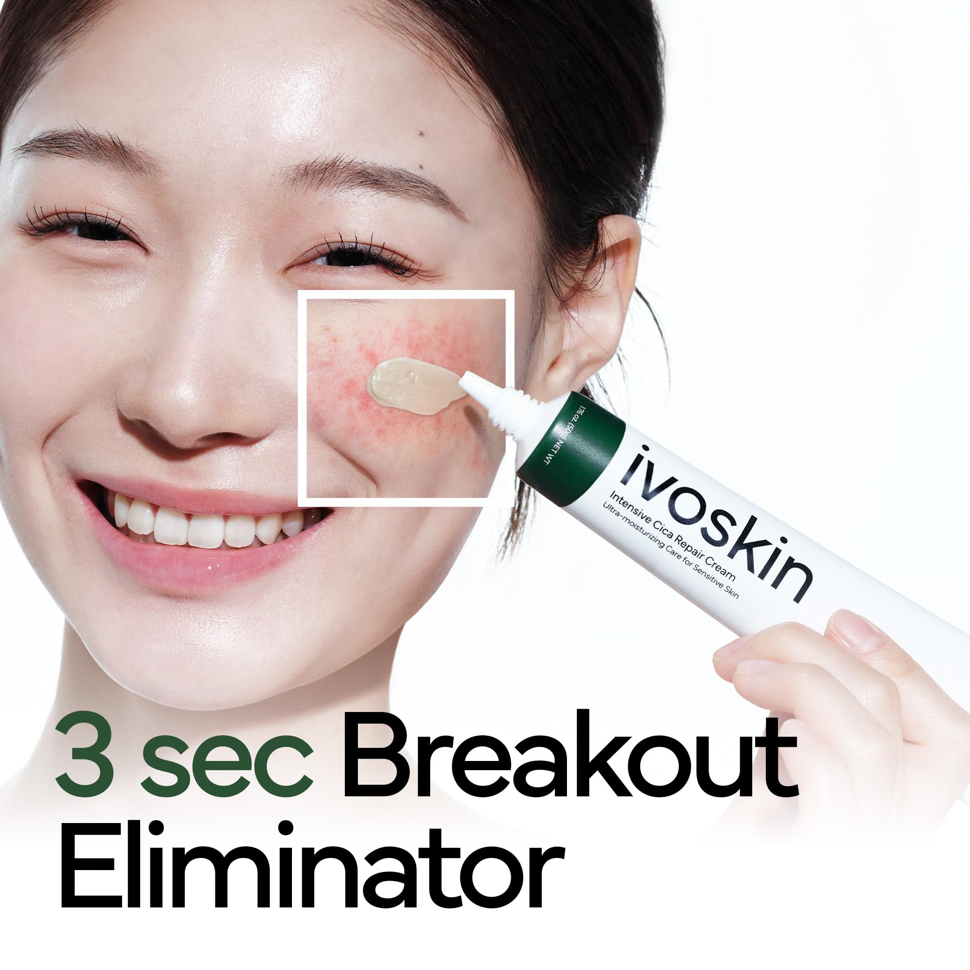 IVOSKIN Cica Relief Crème — teinte verte qui peut neutraliser visuellement les rougeurs.