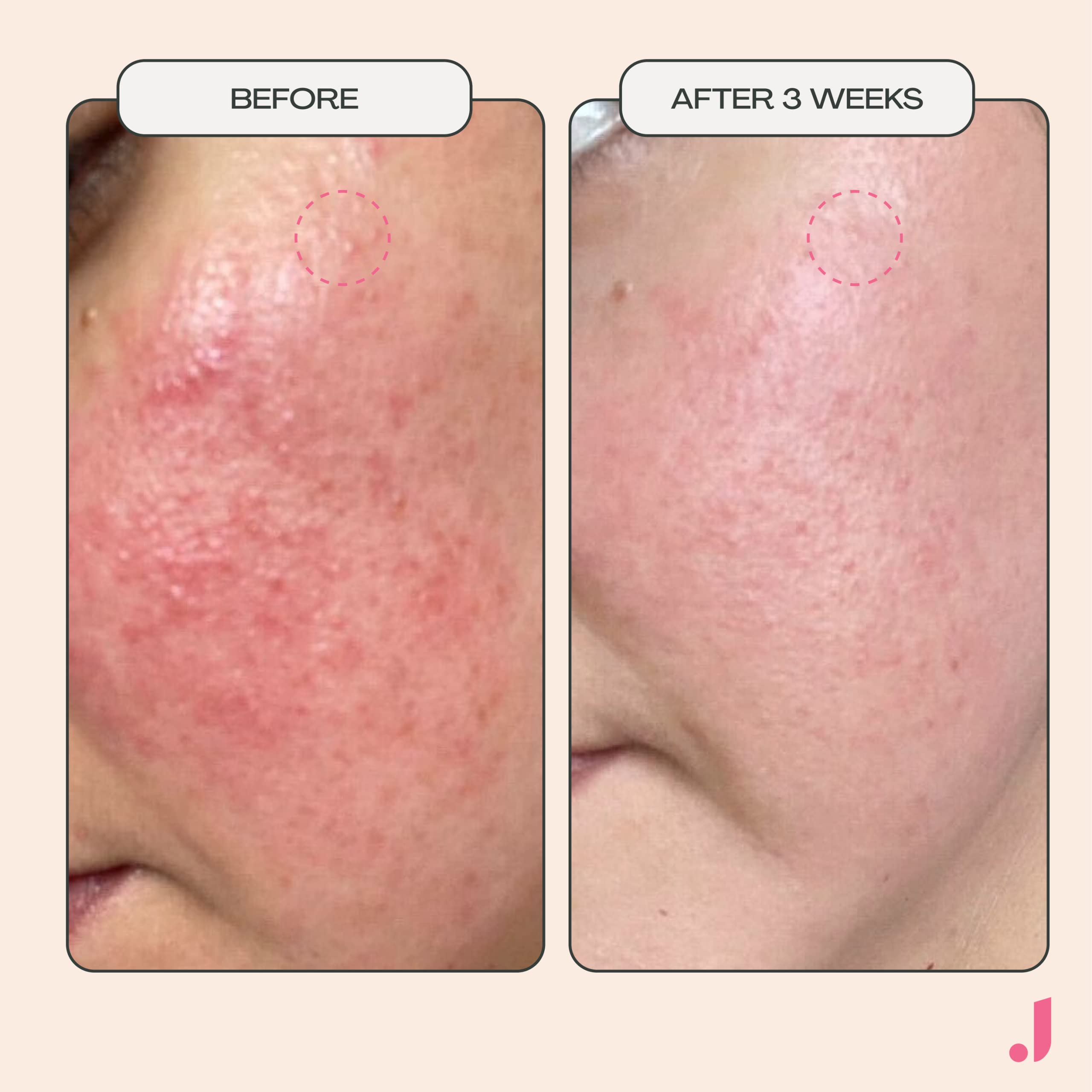 Sensation de fraîcheur durable après application du masque JESS BEAUTY.