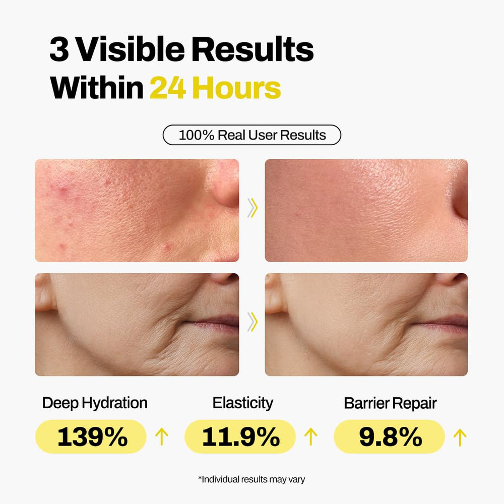 Application de la crème Dermishuttle sur le visage – peau hydratée et lissante.