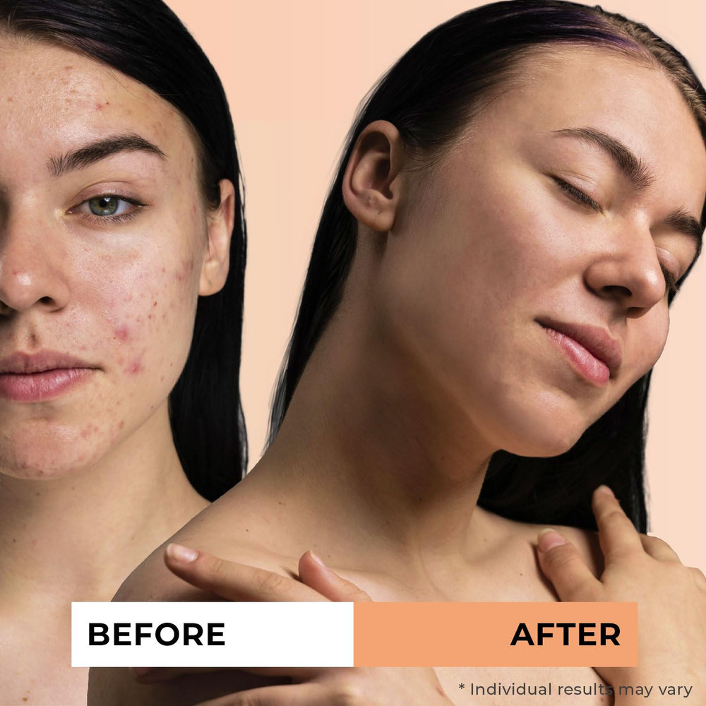 Jeune Naturelle huile dargousier – usage quotidien, voyage pratique.