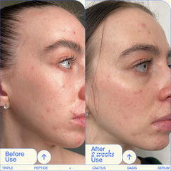 Jeunesse pour les gens - pompe-serum, application précise et contrôle de la quantité.
