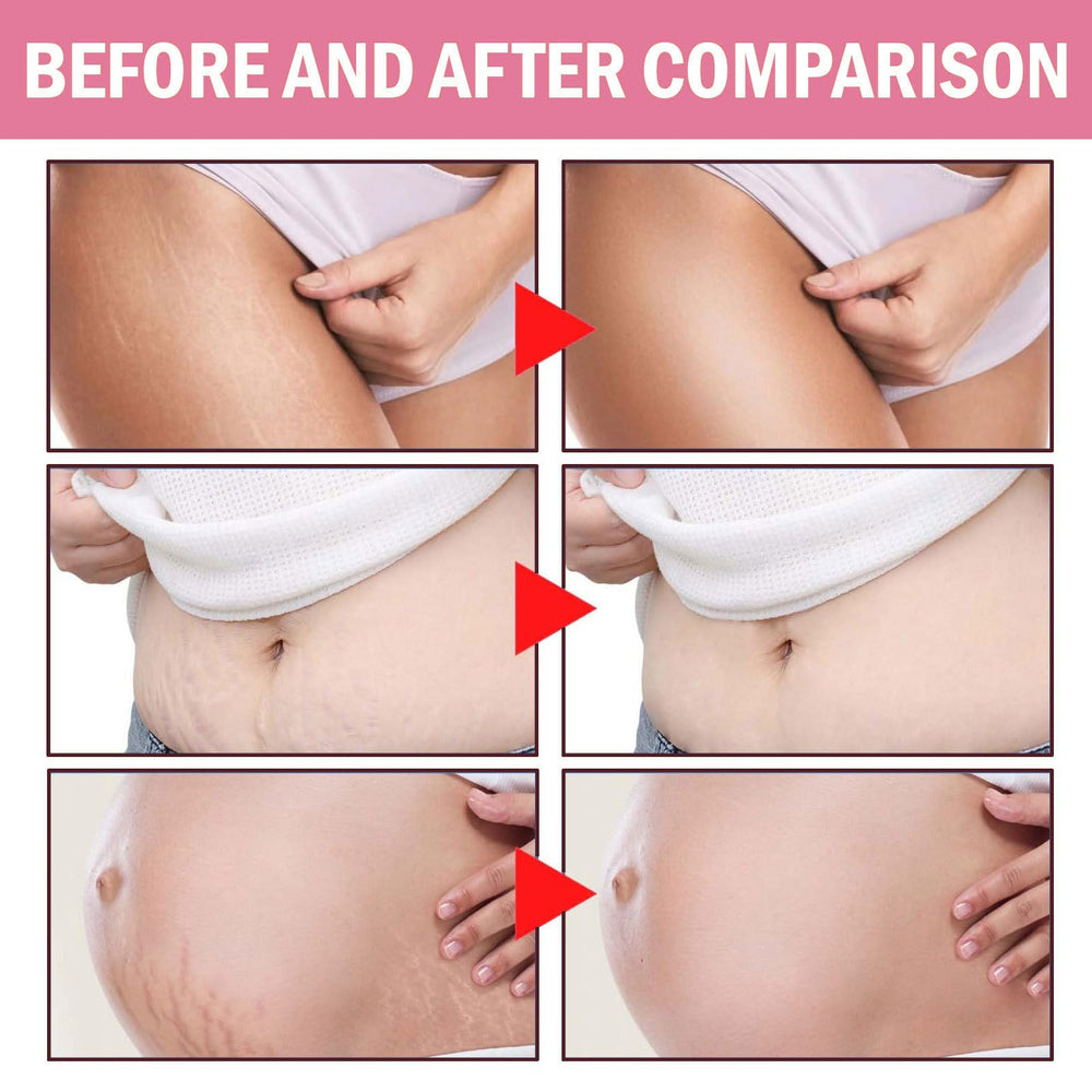 JINMAO Adeus Crème Brésilienne – massage en cercles favorisant l absorption et le confort.