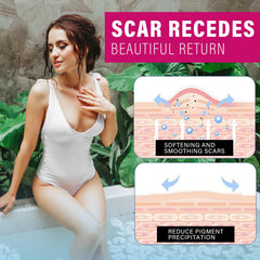 Josera Silicone Cicatrice : texture douce pour un contact confortable sur la peau.