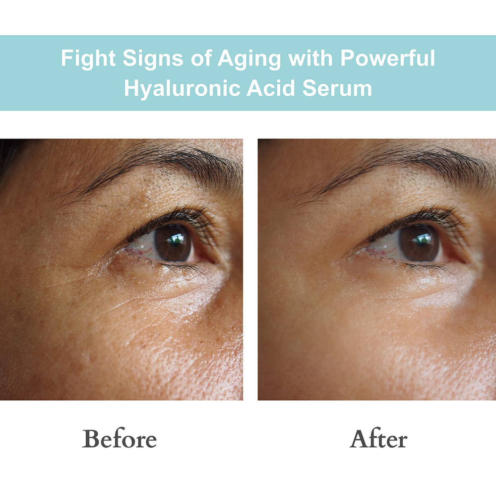 Conservateur naturel Leucidal dans JOYAL BEAUTY Sérum hyaluronique