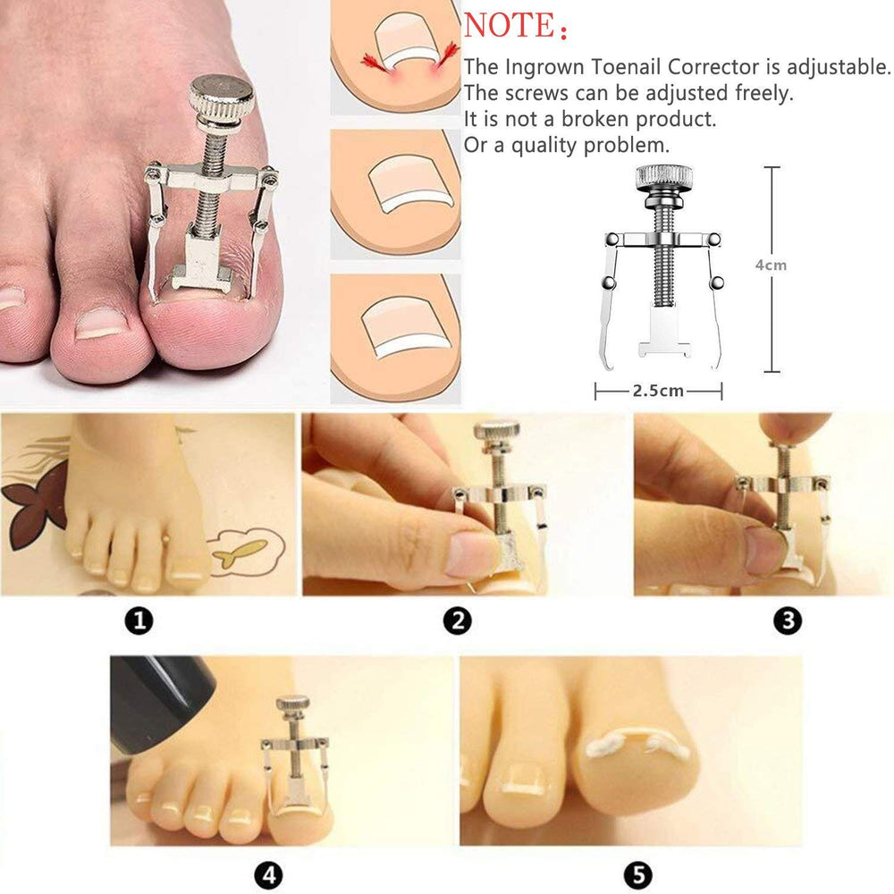 JTIEO outil nettoyage sous-ongle, déloge la saleté sous l'ongle.