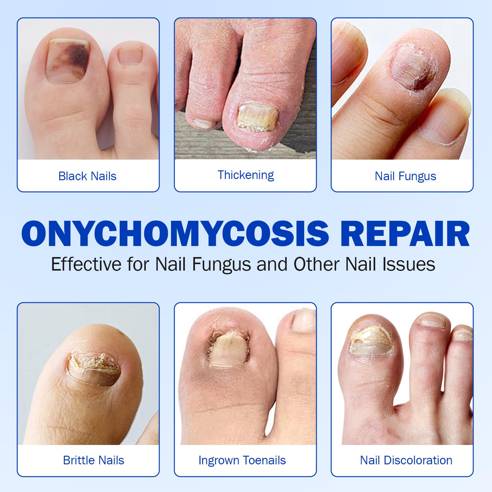 JWBVCTCR normalisation-epaisseur-ongle : épaisseur plus uniforme.