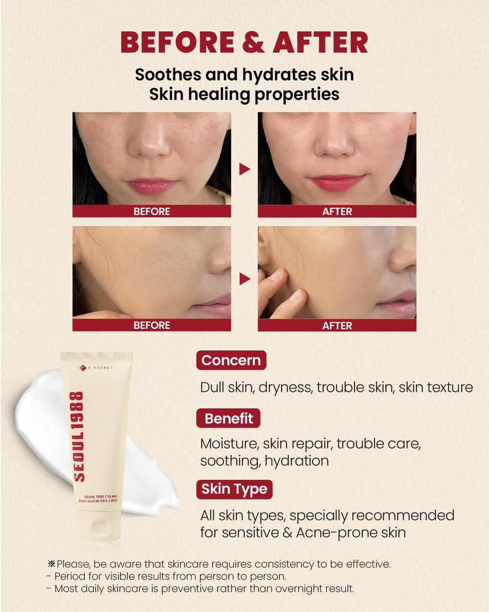 K-SECRET Seoul 1988 absorption-rapide: crème légère qui pénètre rapidement.