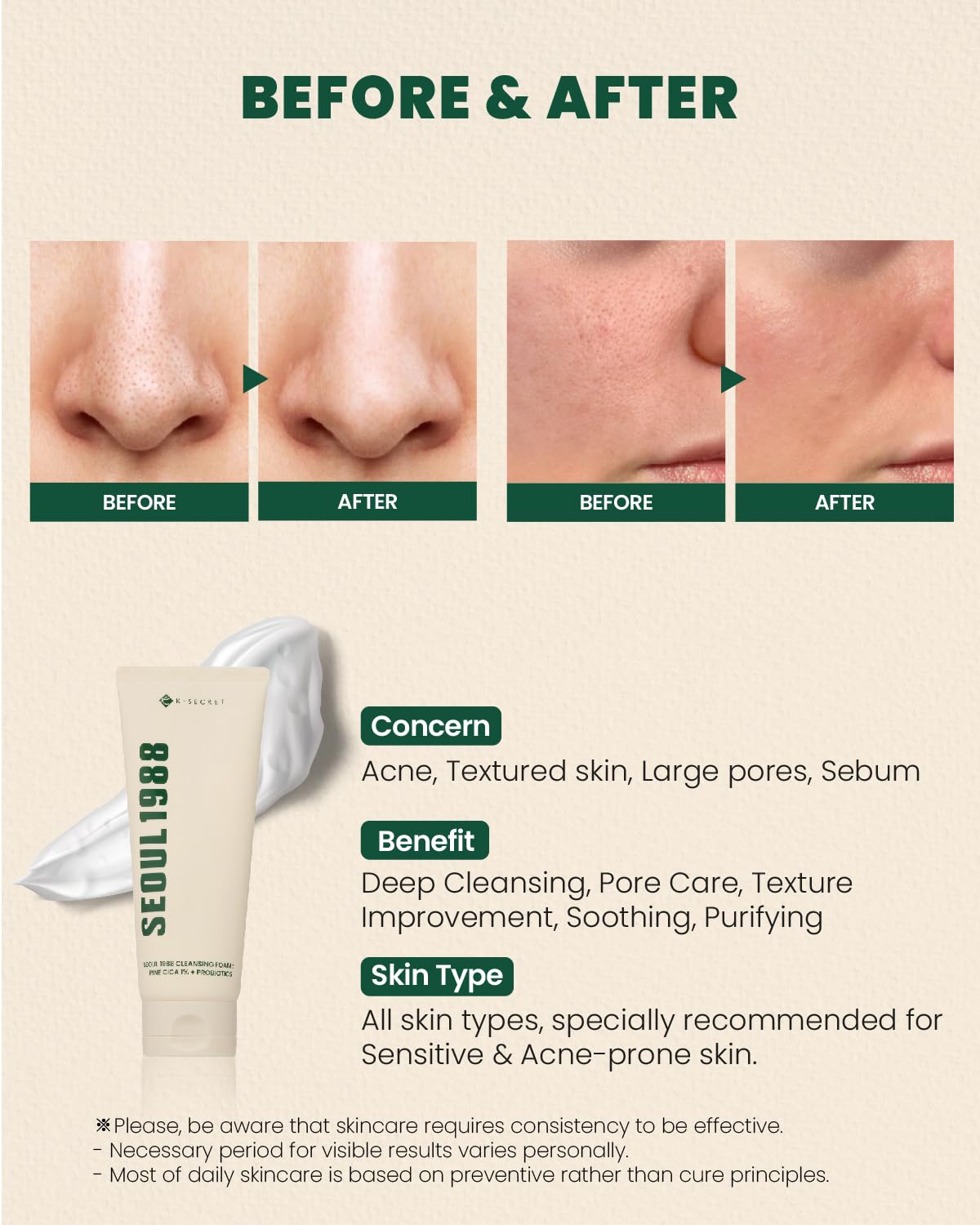 K-SECRET SEOUL 1988 Cica Cleansing Foam: pompe pratique pour routine quotidienne.